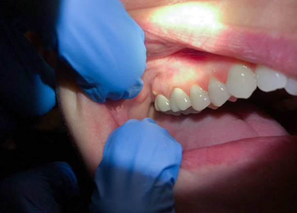 Best Emergency Tooth Extraction in Crown Heights, NY